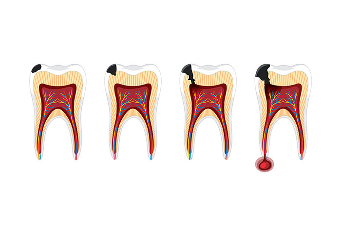 Endodoncia Home